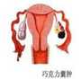 合肥亲戚帮忙代孕,北京朝阳医院试管婴儿怎么样？试管婴儿成功率高不高？_试